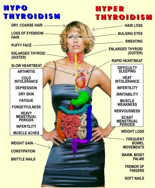 thyroid-problems